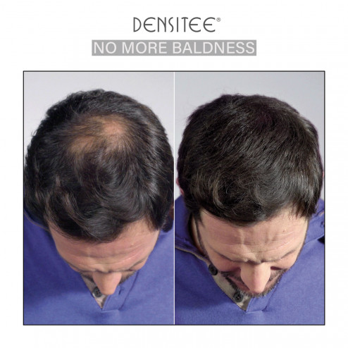 Poudre denfiante pour masquer calvitie des cheveux - Homme